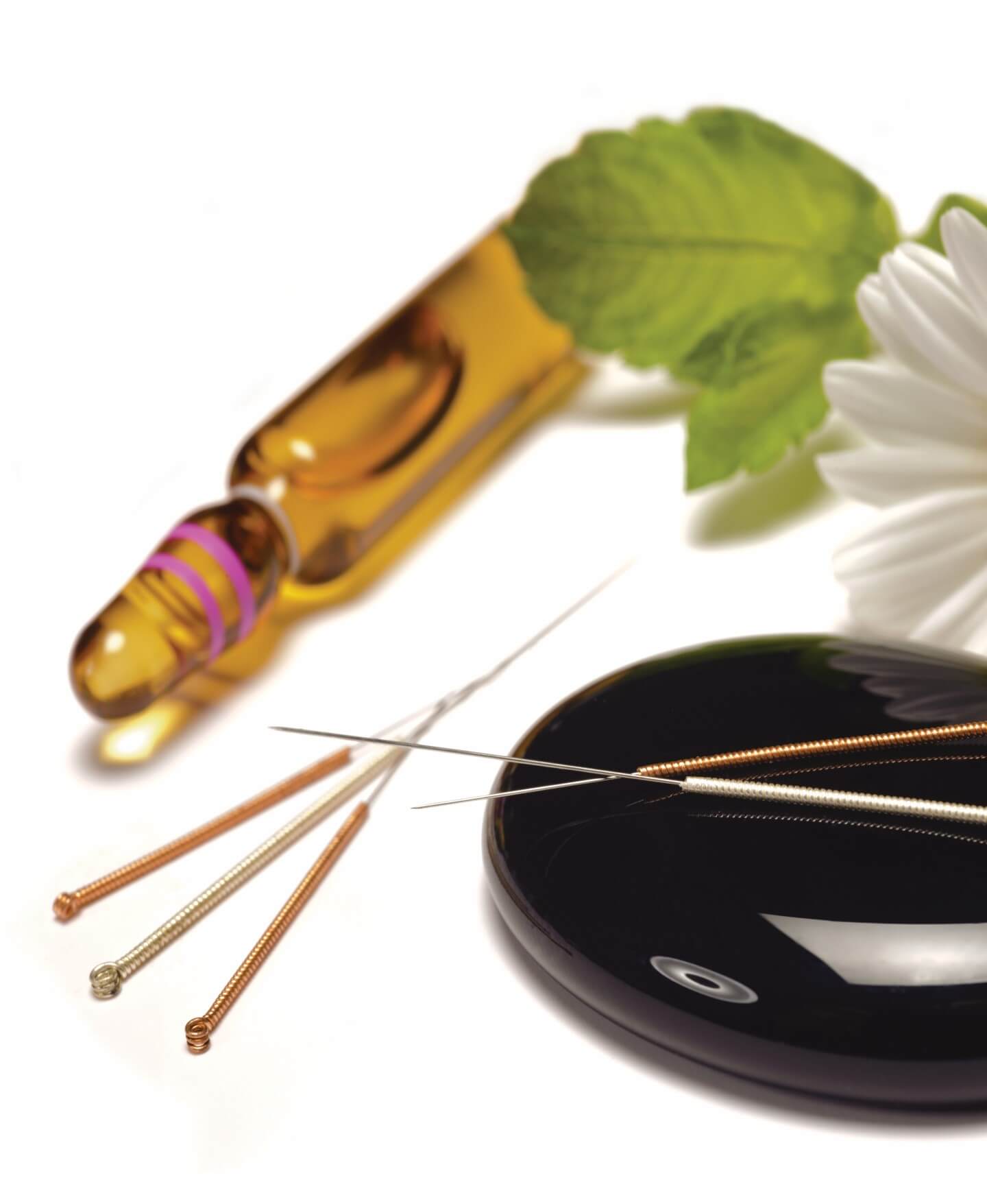 Acupuncture Services